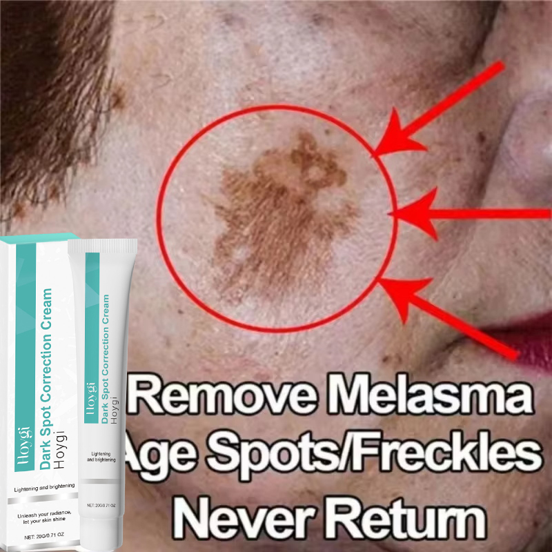 Luxury Skincare Brands - Powerful Spot-removing Whiten Cream Brighten Skin