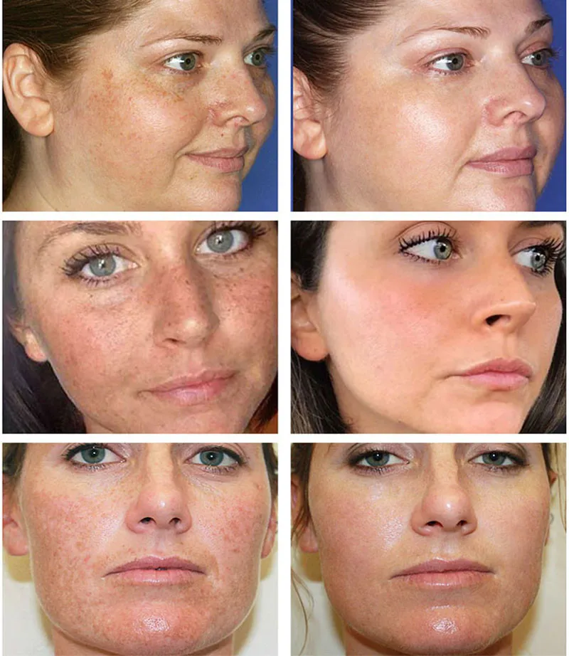 Powerful Spot-removing Whiten  - Luxury Skincare Brands ulasan dan harga
