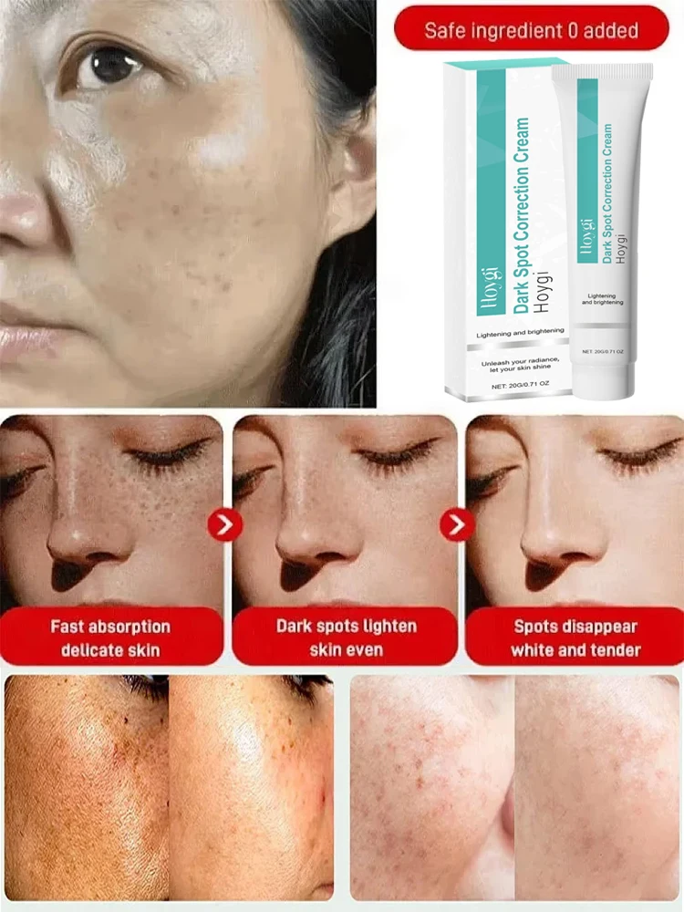 Powerful Spot-removing Whiten  - Luxury Skincare Brands ulasan dan harga