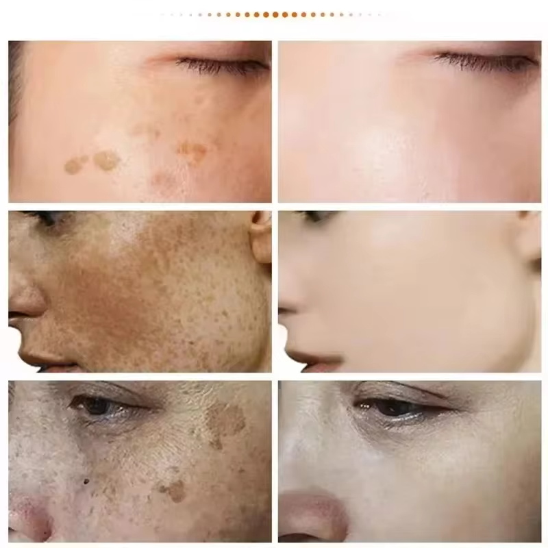 Powerful Spot-removing Whiten  - Luxury Skincare Brands ulasan dan harga