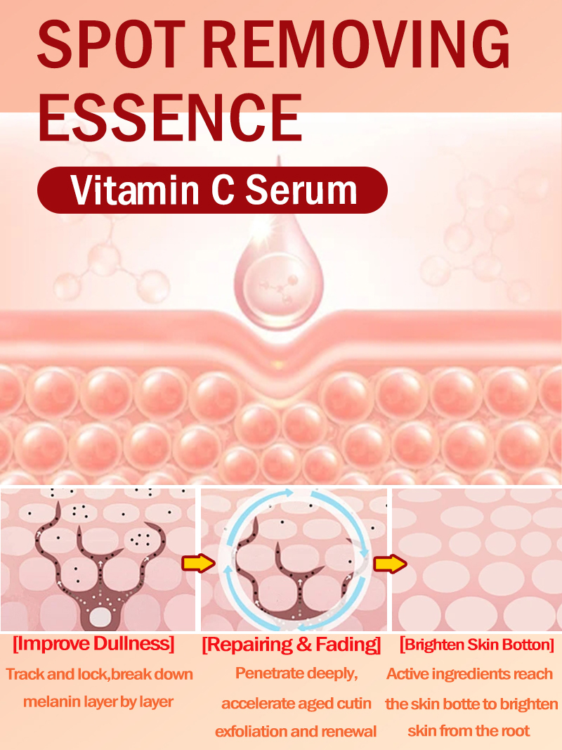 Lighten Freckles Melasma, Faci - Luxury Natural Skincare ulasan dan harga